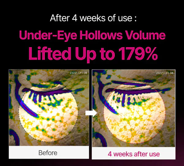 Calcium Dark Spot Cover Eye Cream